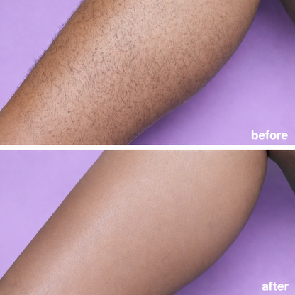 Endovera™ Hair Removal Cream