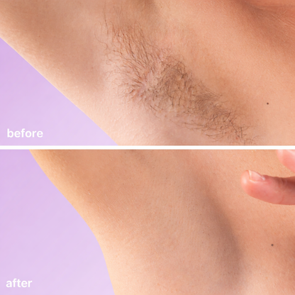 Endovera™ Hair Removal Cream
